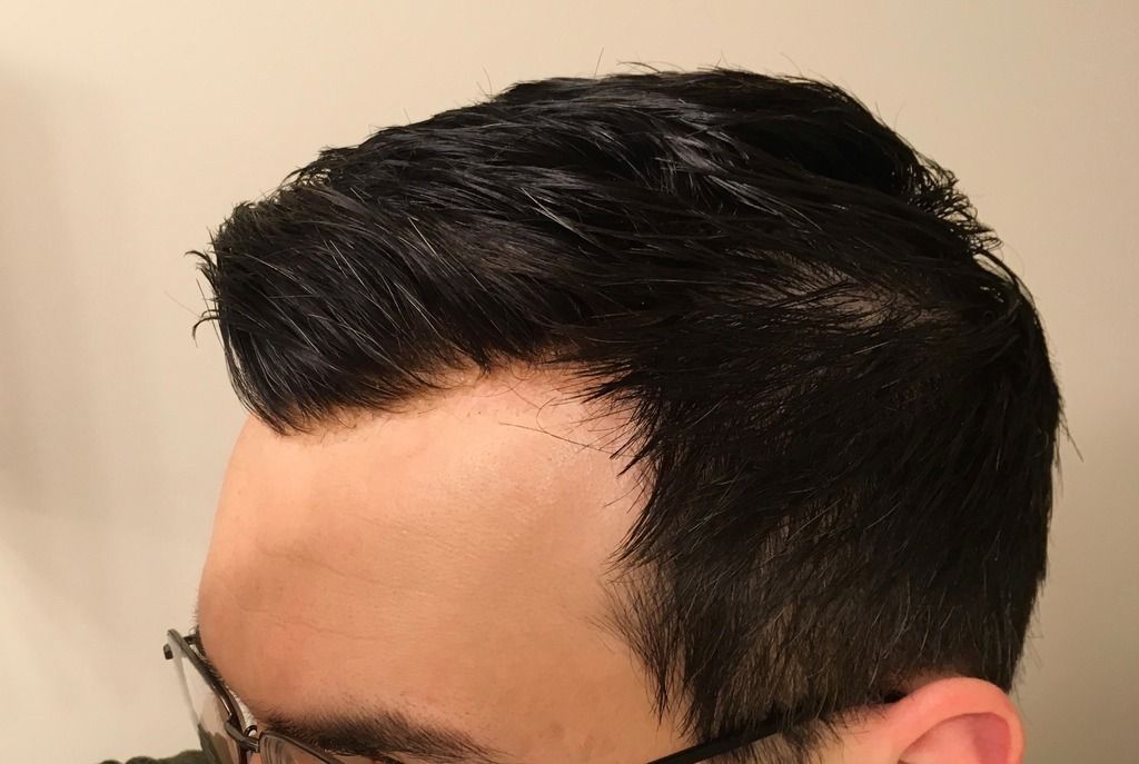 Northwest Lace Llc Hair Loss Forum Northwestlace Com | northwest lace llc hair loss forum northwestlace here Northwest Lace Llc Hair Loss Forum Northwestlace Com | northwest lace llc hair loss forum northwestlace here