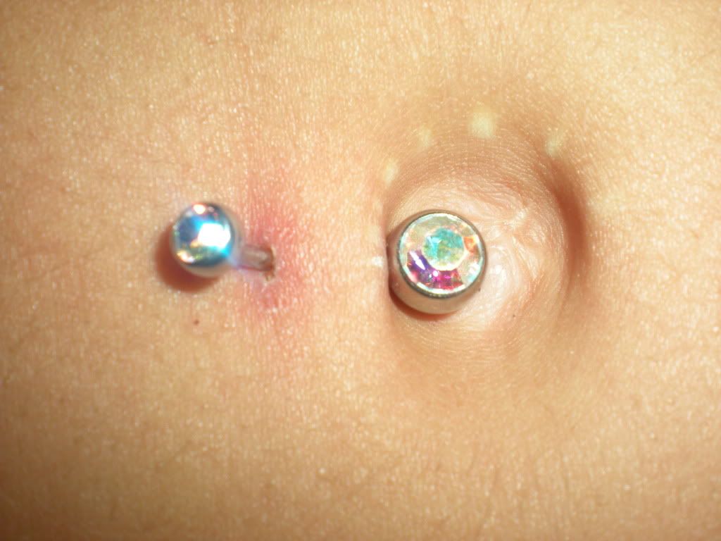 is-my-belly-button-ring-being-rejected-getting-infected-or-just